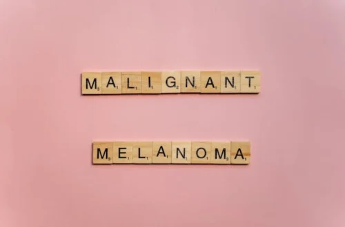 Pahanlaatuisen melanooman visuaalinen esitys, joka korostaa melanooma kuvina keskeisiä näkökohtia informatiiviseen käyttöön.