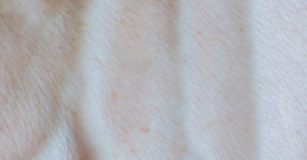 Solarium - Solariumien vaarat paljastettu: Kuinka sisäsäteily kiihdyttää melanooman riskiä