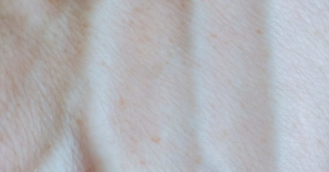 Solarium - Solariumien vaarat paljastettu: Kuinka sisäsäteily kiihdyttää melanooman riskiä