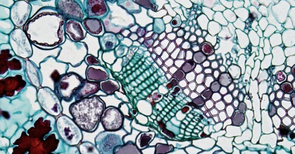 Paksusuolisyöpä - Krooninen suolistotulehdus voi lisätä paksusuolisyövän riskiä: Murtamassa immunologisen ketjureaktion mysteeriä