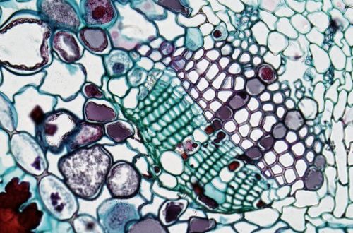 Paksusuolisyöpä - Krooninen suolistotulehdus voi lisätä paksusuolisyövän riskiä: Murtamassa immunologisen ketjureaktion mysteeriä