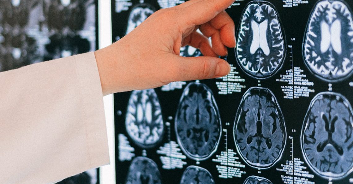 musiikki - Miksi Musiikin Ilo Ei Kosketa Kaikkia? Selitys Aivojen Mysteeriin