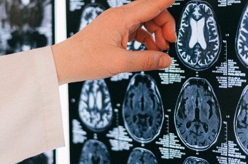 musiikki - Miksi Musiikin Ilo Ei Kosketa Kaikkia? Selitys Aivojen Mysteeriin