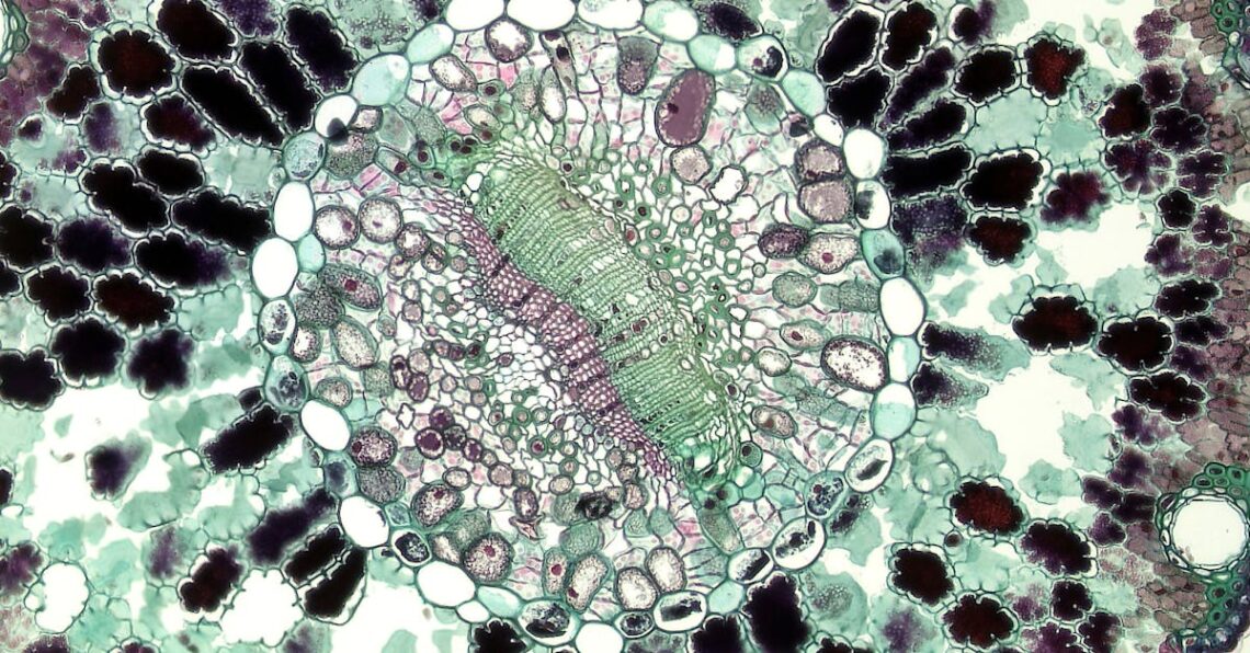 Syöpä - Läpimurtoja syövän piiloutumisessa: Kuinka immuunijärjestelmä voi voittaa haimasyövän